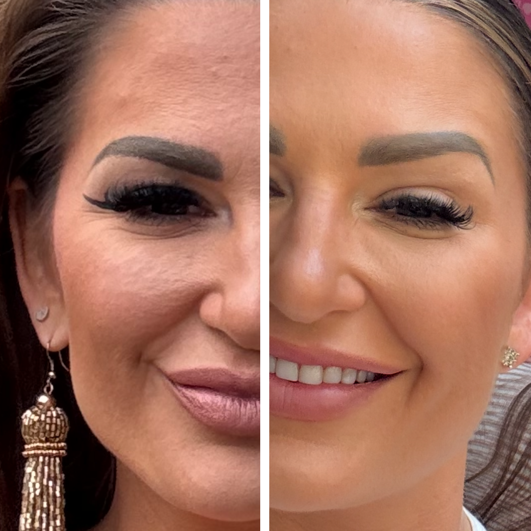 Side-by-side comparison of a woman's face with and without makeup, focusing on eye and lip area.