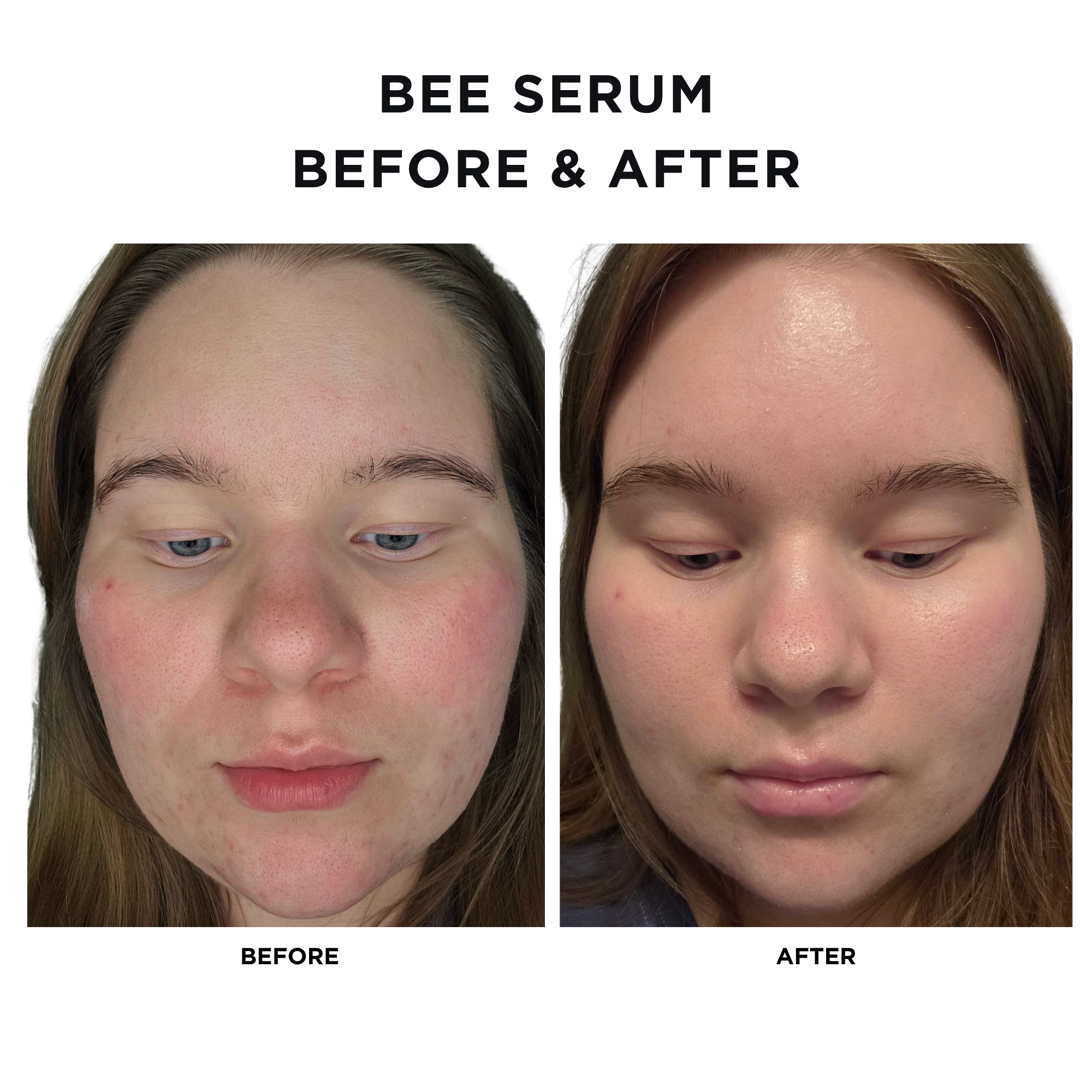 Bee Serum