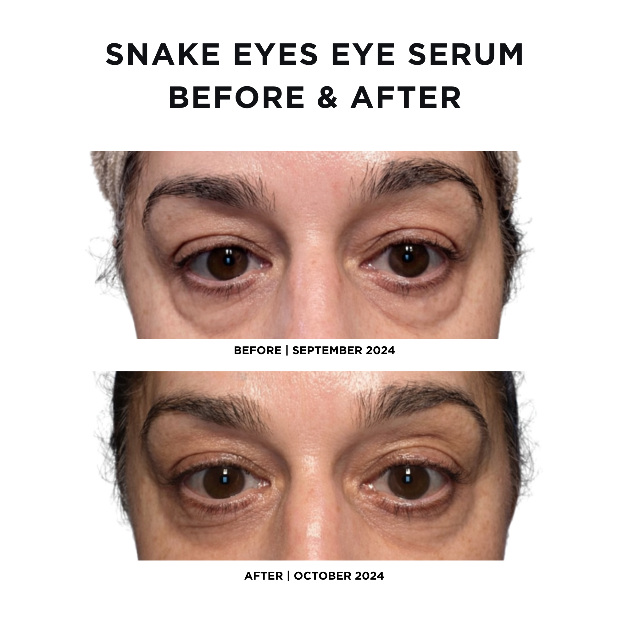 Snake Eyes Eye Serum