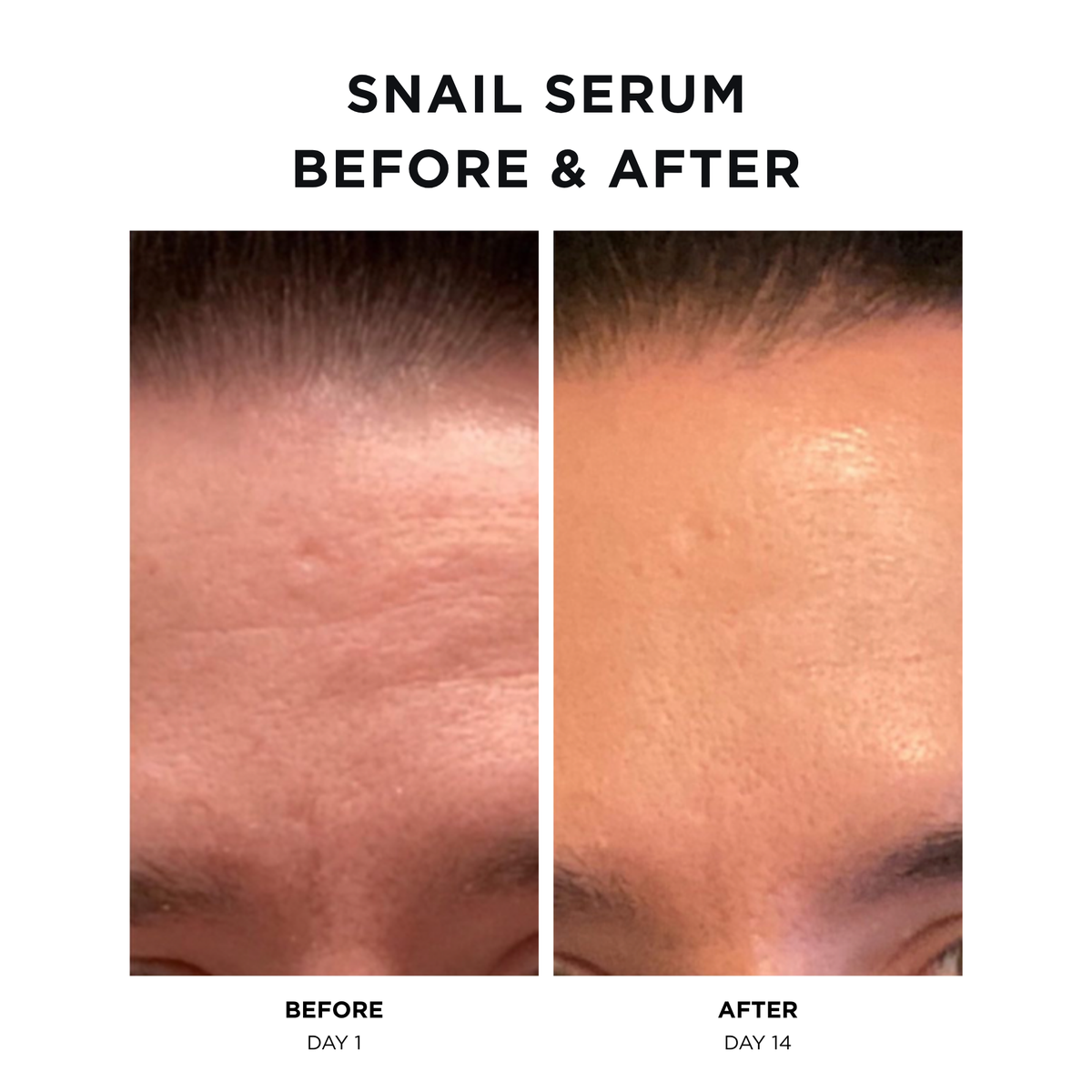 Mini Snail Serum