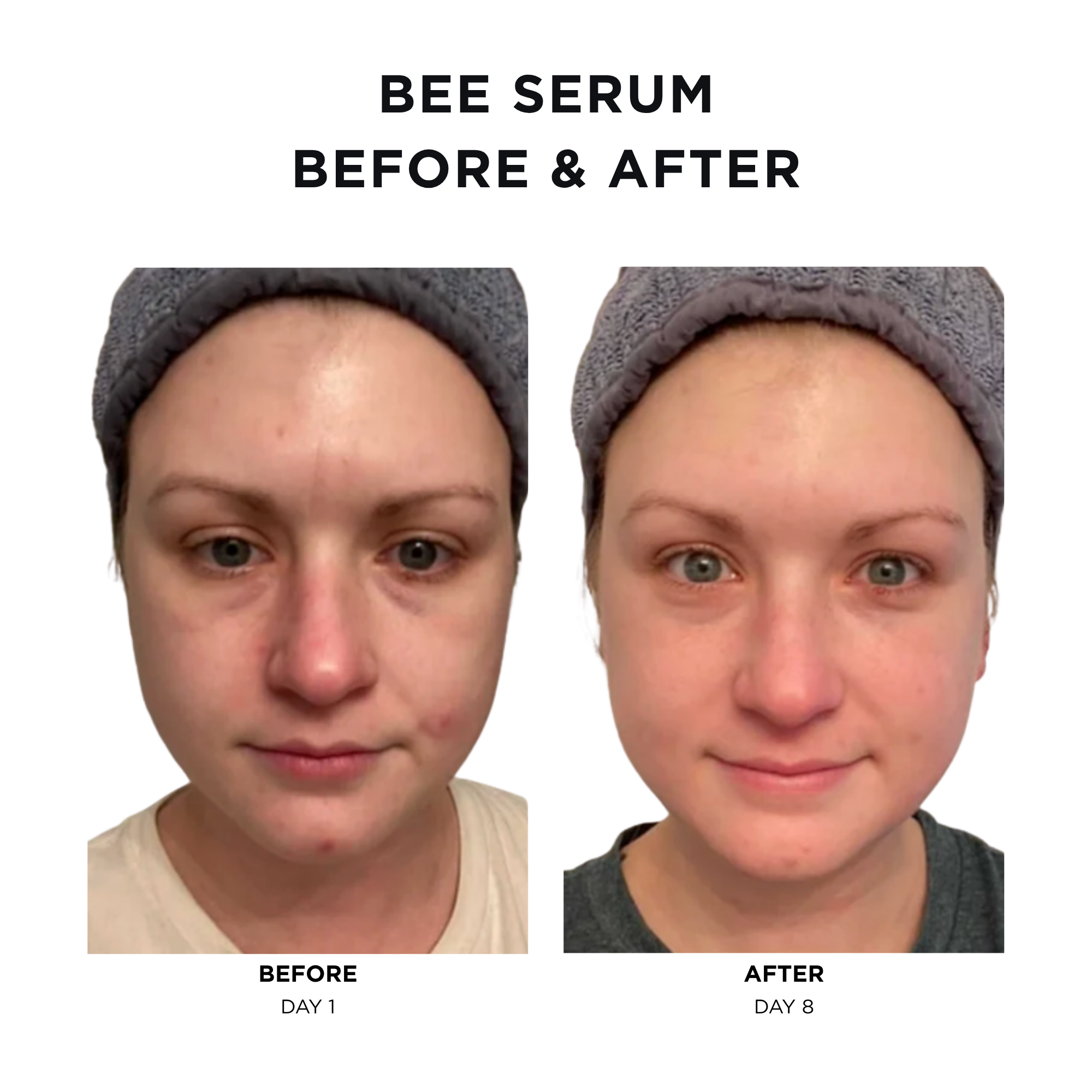 Bee Serum + Antidote Moisturizer