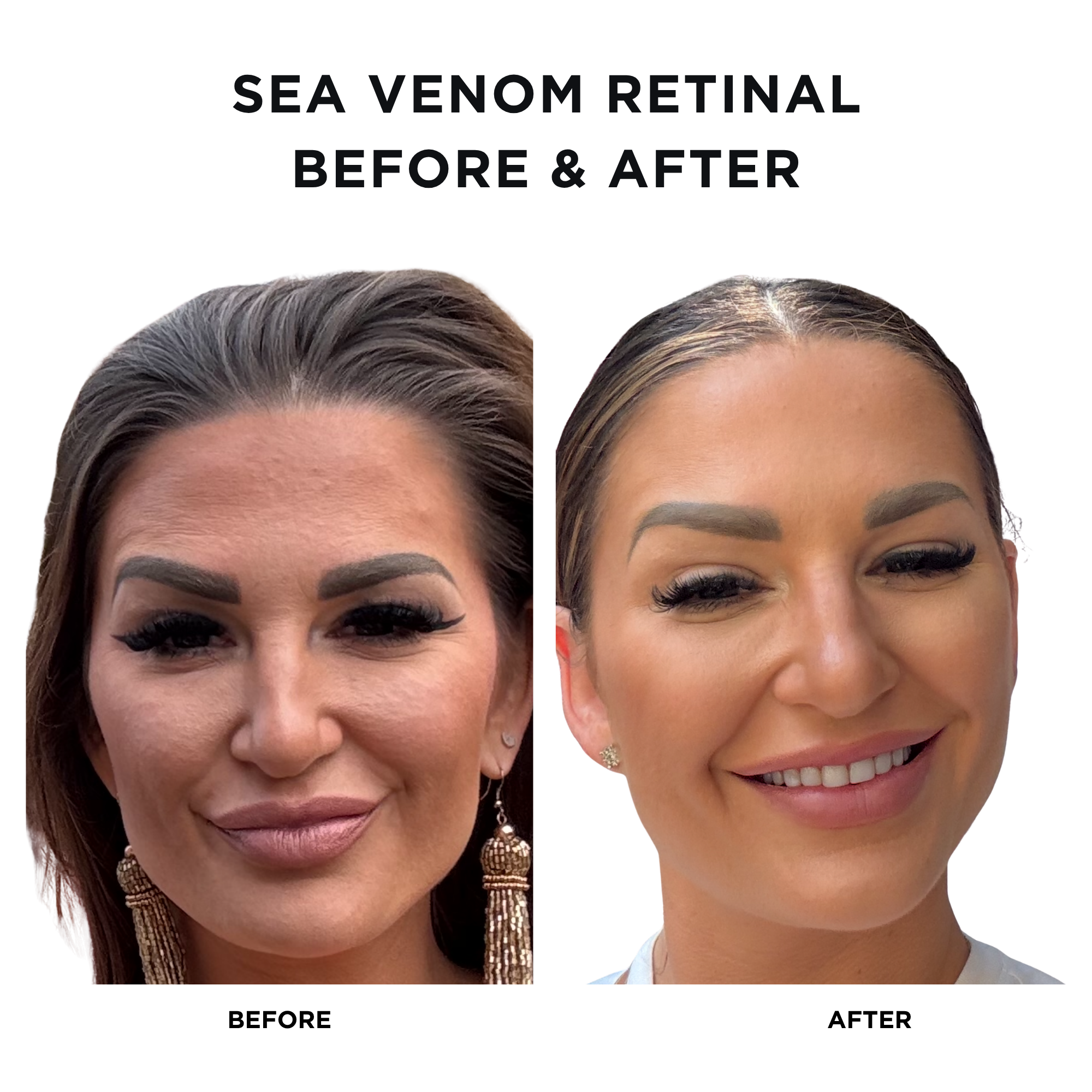 Sea Venom Retinal