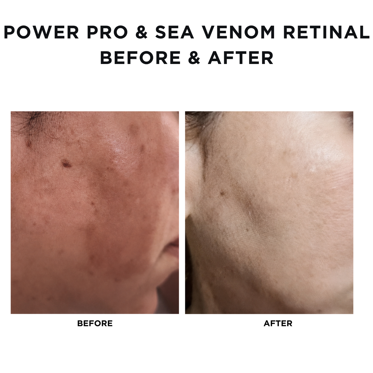 Power Pro Peel Pads