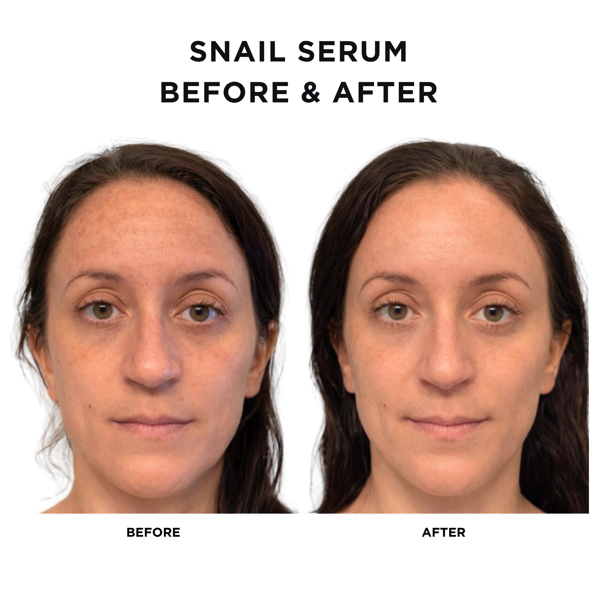 Snail Serum