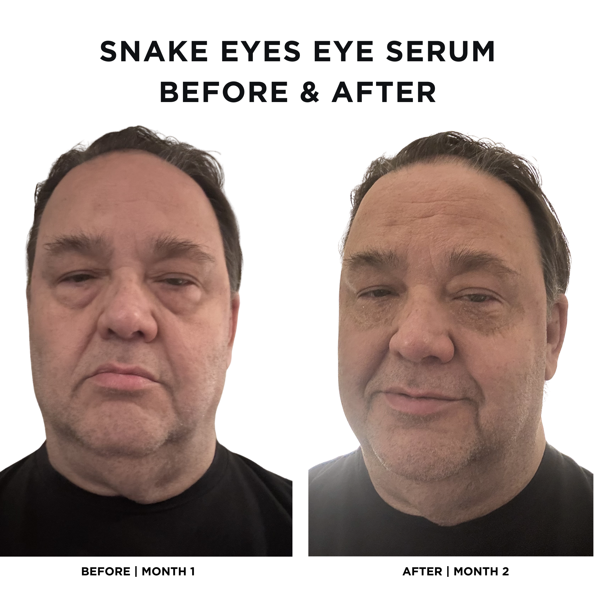 Snake Eyes Eye Serum