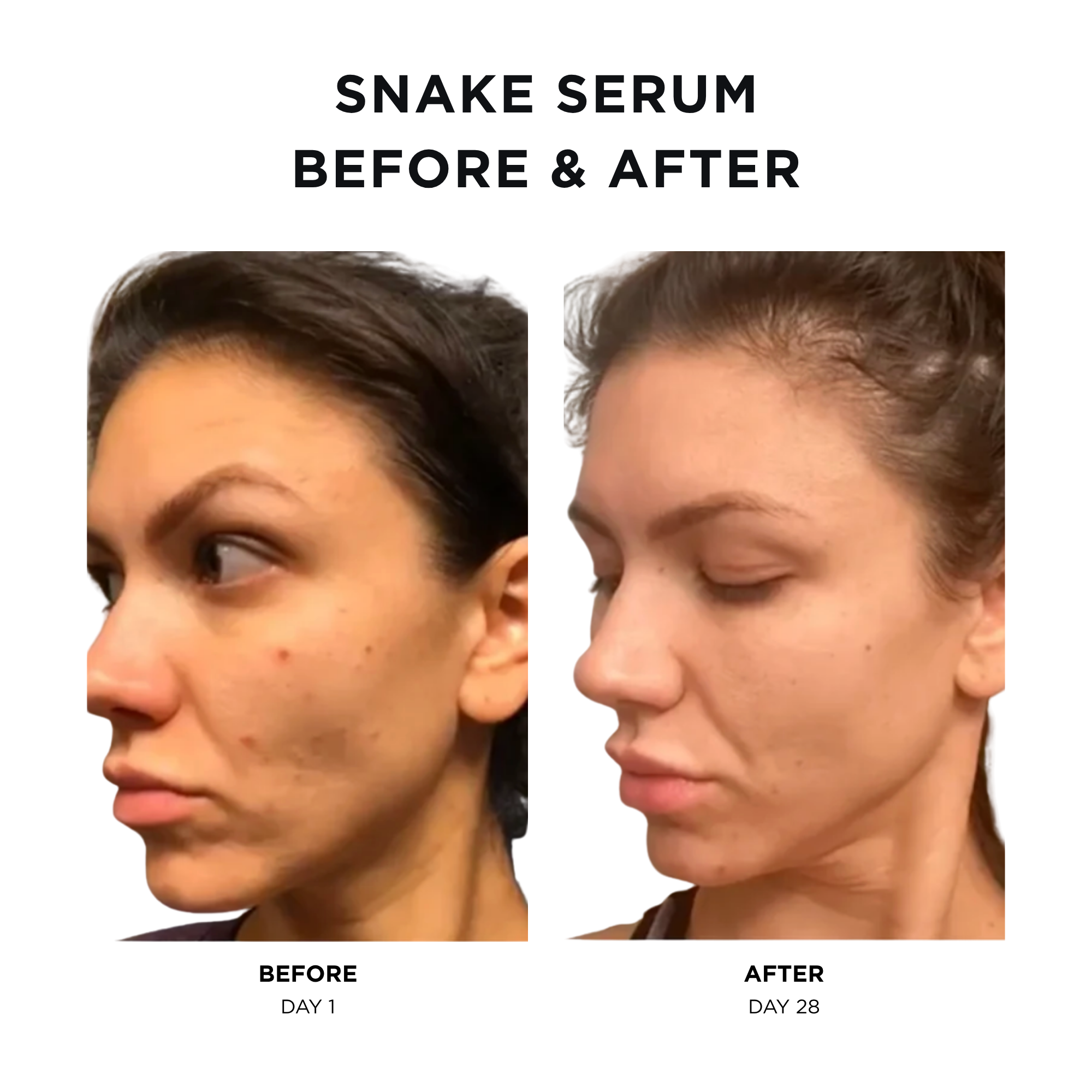Snake Serum