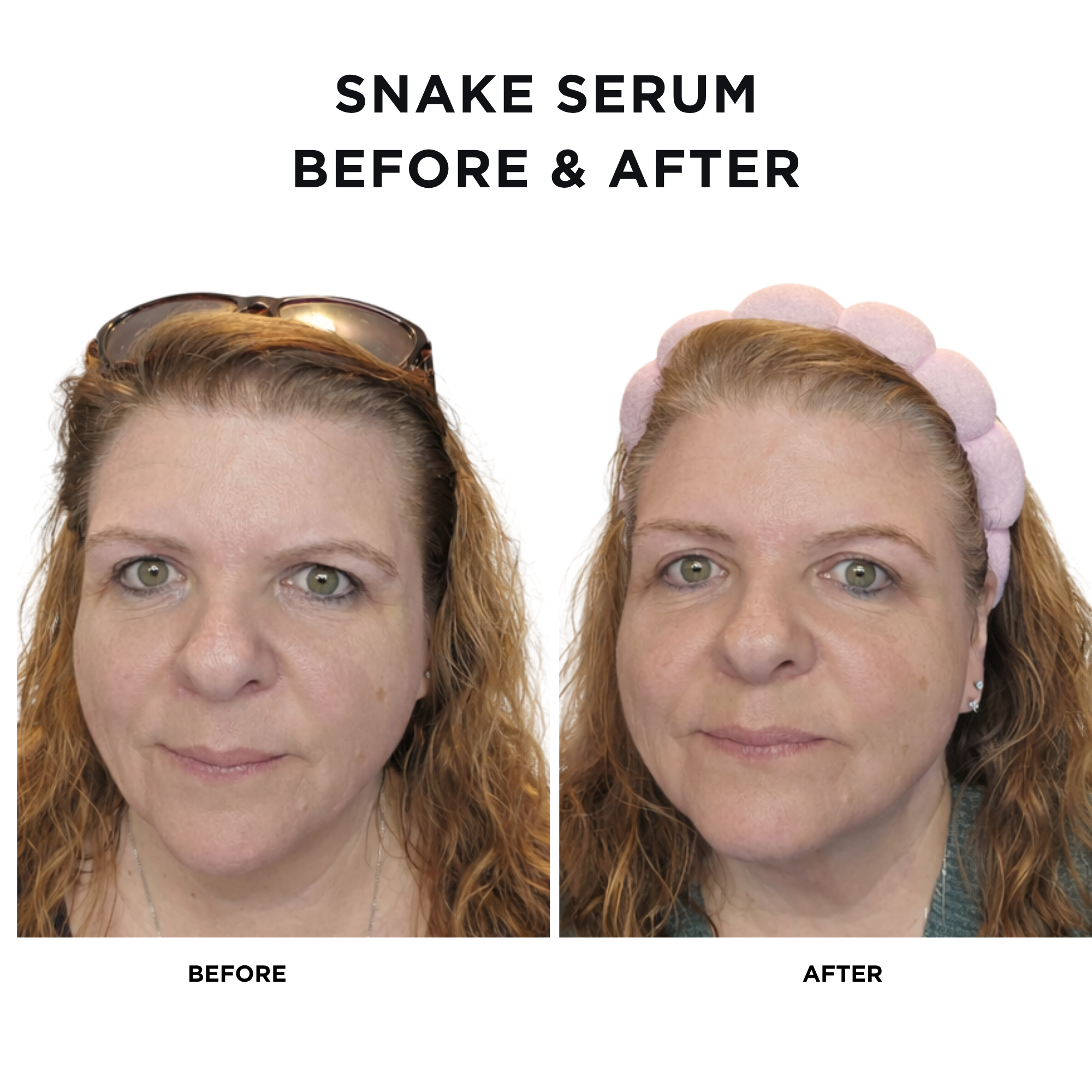Snake Serum + Intoxicated Cosmetics Hat