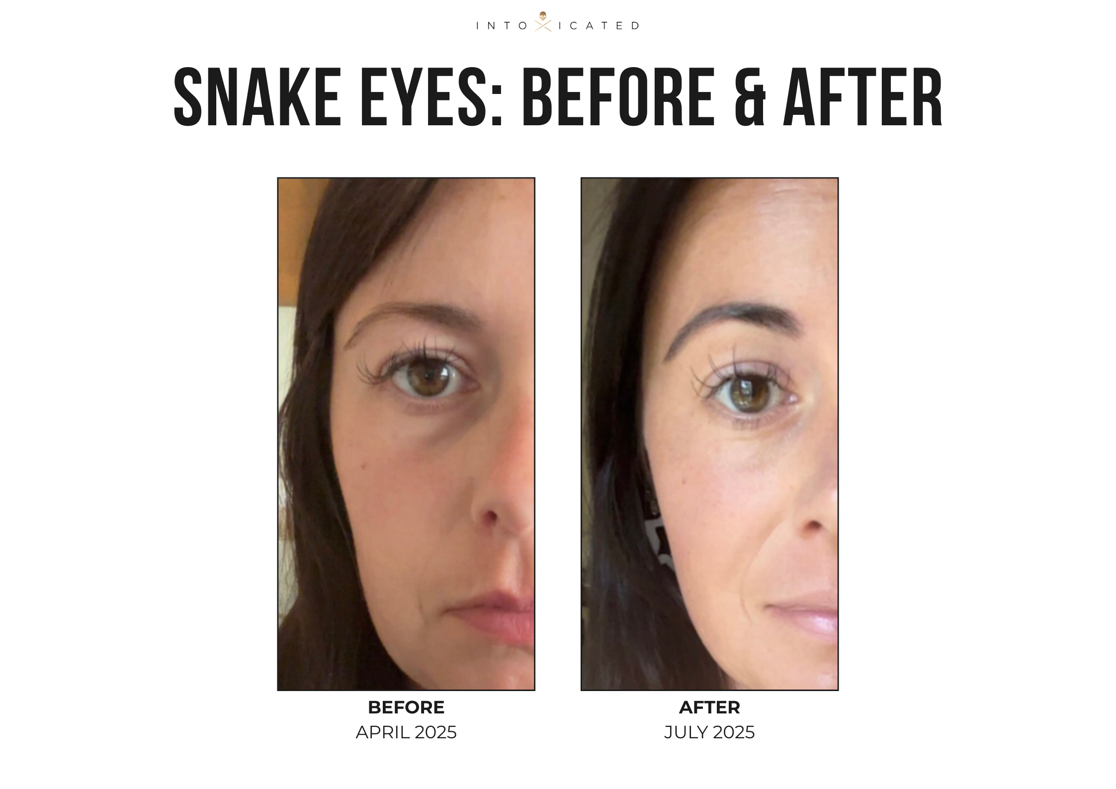 Snake Eyes Eye Serum