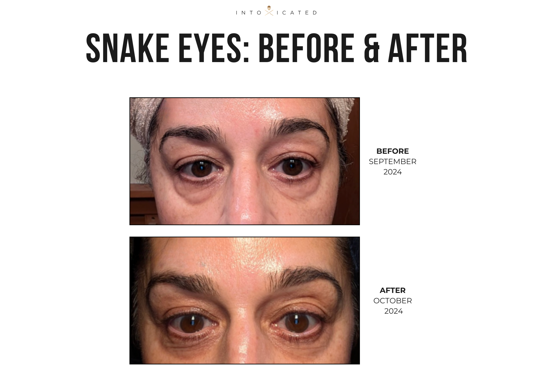 Snake Eyes Eye Serum