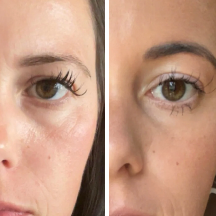 Snake Eyes Eye Serum