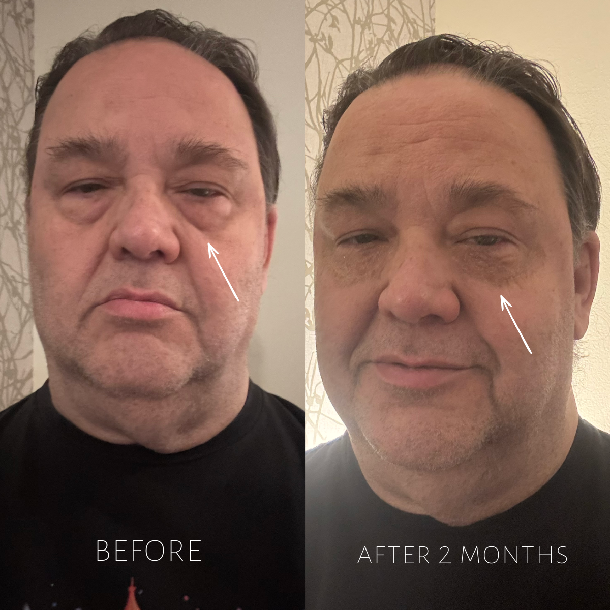 Snake Eyes Eye Serum